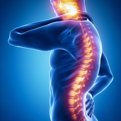 What is Chiropractic BioPhysics? Chiropractic Care in Fairfield CT